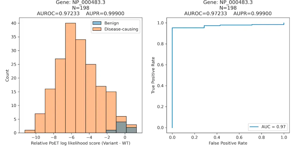CFTR variant analysis showing histogram and AUROC curve